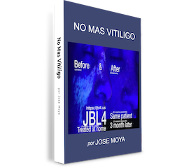 No Más Vitiligo